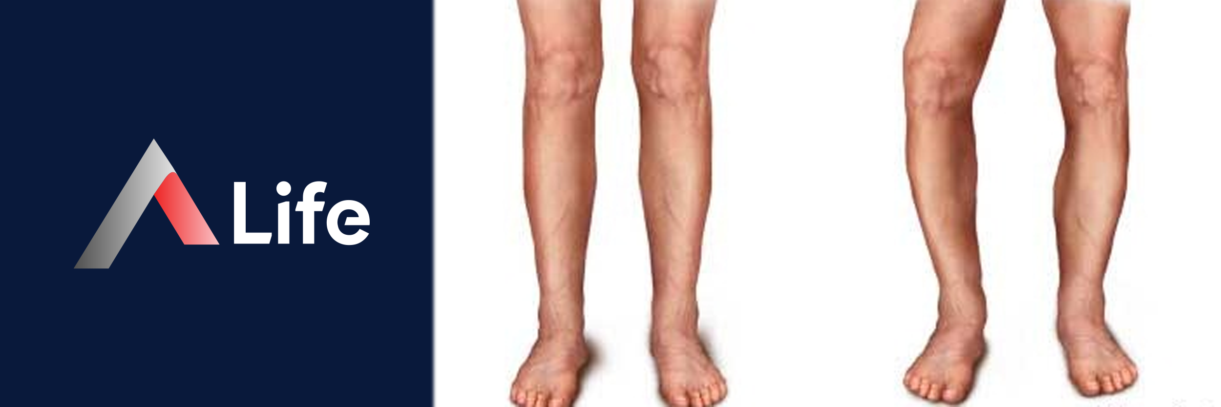 600x200_Makale_G__rsel_Tasla_____ps_f__rat_c9ff81ea.webp