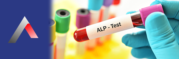 ALP_Testi_8ec94200.webp