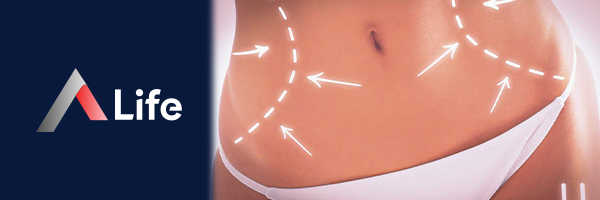 Abdominoplasti_594dbb58.webp