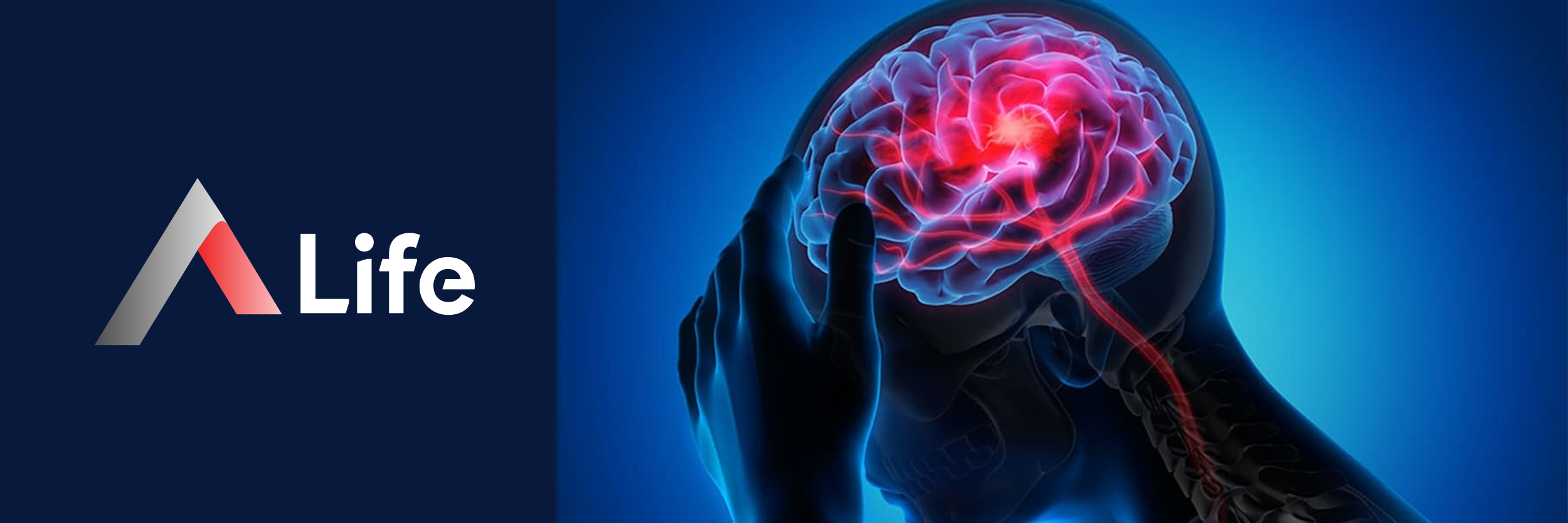 [Resim: Akut___nme_Nedir_5a624f5d.webp]