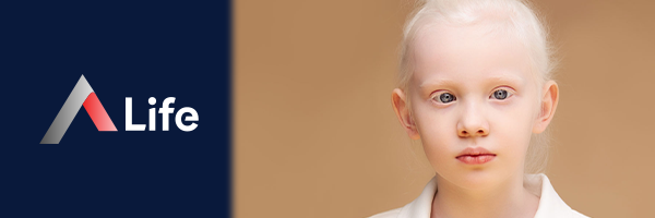 Albino_Nedir_039c1518.webp