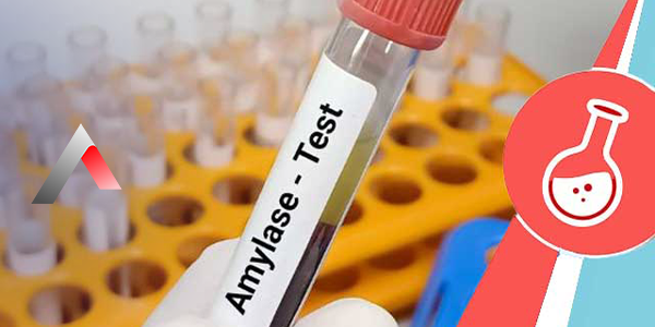 Amilaz_Testi_6ce8627a.webp
