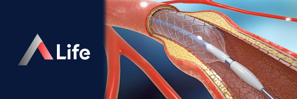 Anjiyoplasti_ve_Stent_Yerle__tirmek_33f81f84.webp