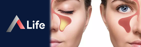 Burun_T__kan__kl_______ee36a9fc.webp