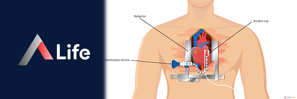 CABG_Nedir_7ed0e059.webp
