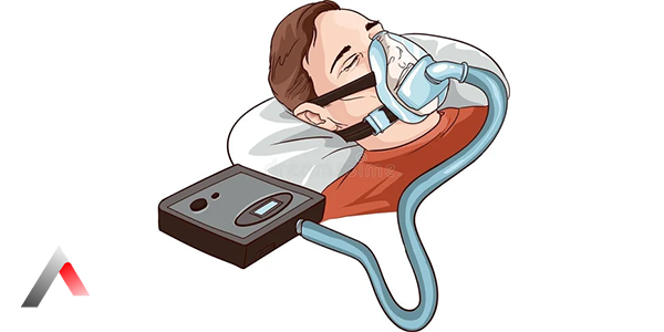 CPAP_Titrasyon_dc33f4ce_8f1fb987.webp