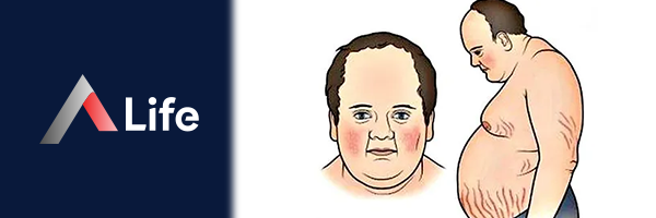 Cushing_Sendromu_d88cb58c.webp