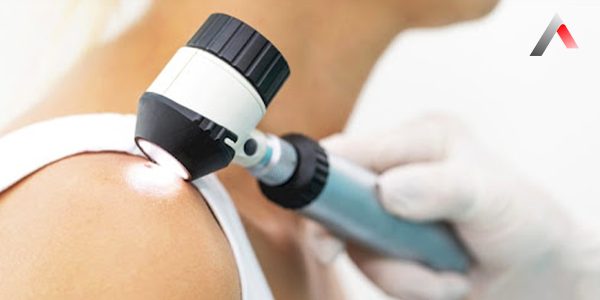 Dermatoskop_Nedir_ddb472e7.webp