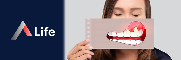 Di___Eti___ekilmesine_Ne___yi_Gelir_79d513ea.webp