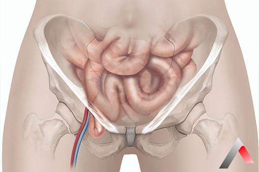Femoral_F__t__k_c0da340f.webp
