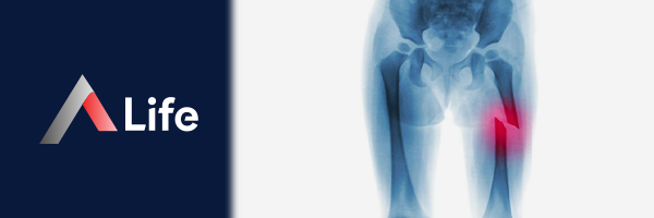 Femur_K__r_______e8b9c285.webp