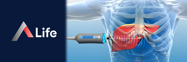 Fibroscan_Nedir_68f69724.webp