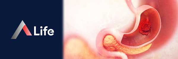 Gastrointestinal_Kanama_055a7a6d.webp