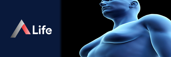 Gynecomastia_494b47d4.webp