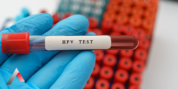 HPV_Testi_b7f60be7.webp