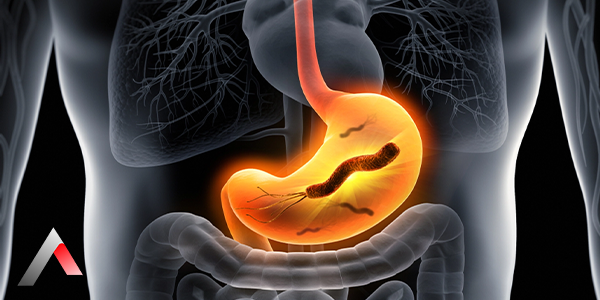 Helicobacter_Pylori_0beeeadc.webp