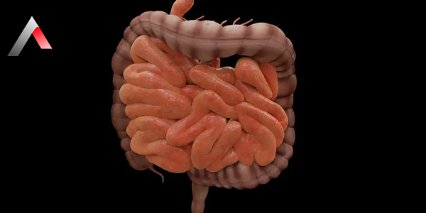 Hirschsprung_Hastal_______deb824d4.webp