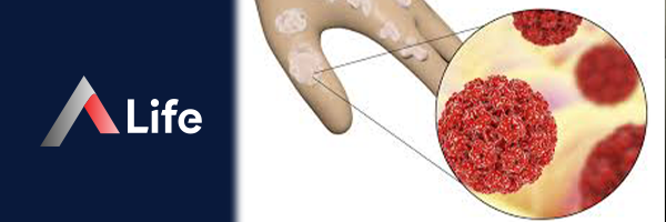 Human_Papillomavirus_Nedir_11a1f6d0.webp