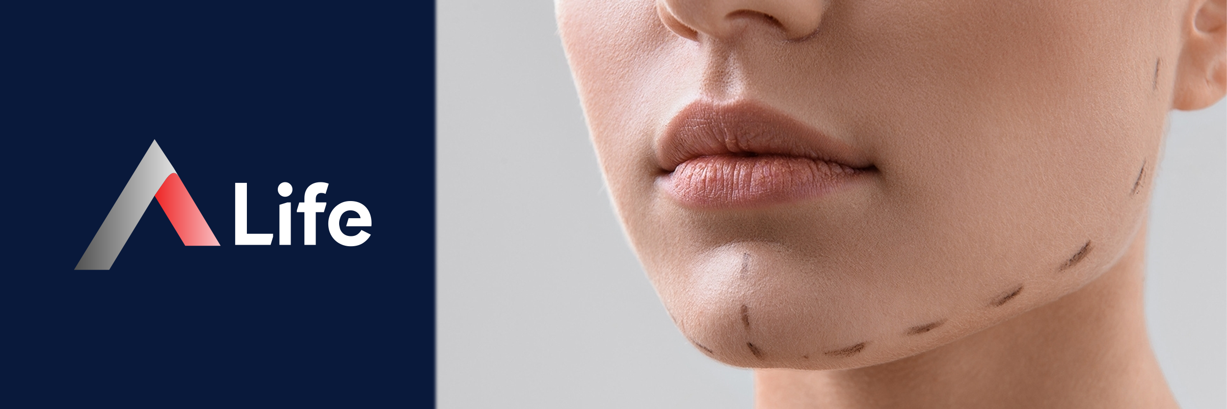 Jawline_Dolgusu_Hakk__nda_S__k_Sorulan_Sorular_a51f81d4.webp