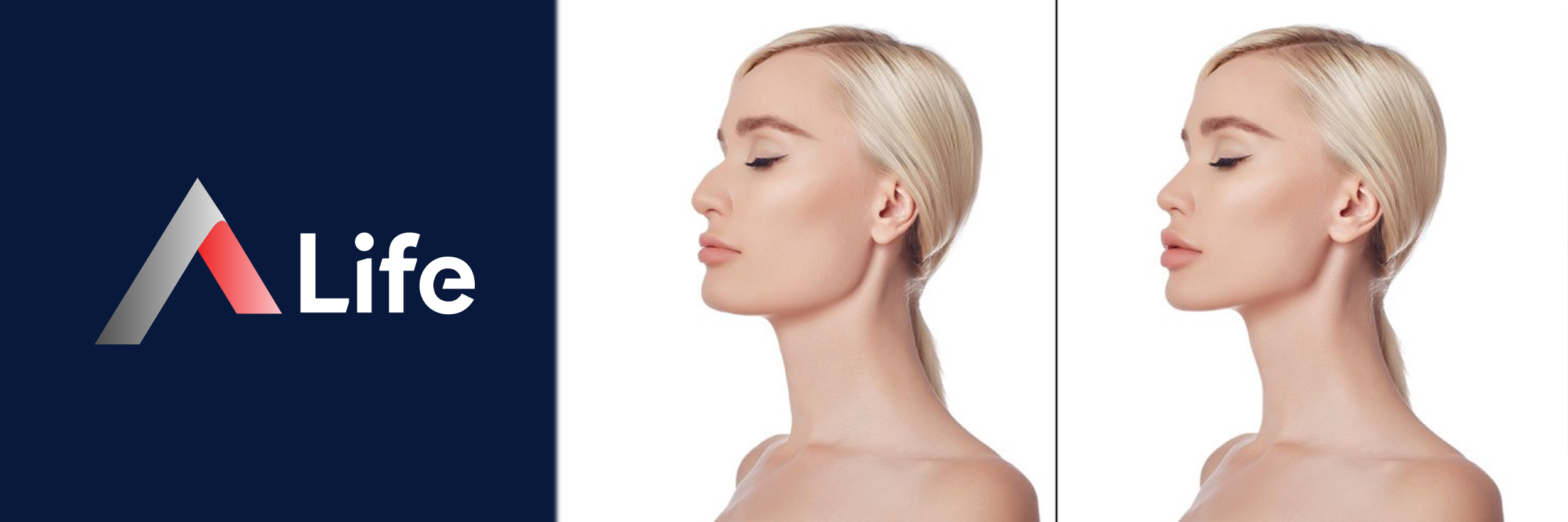 Jawline___ene_Dolgusu_25c76cb7.webp