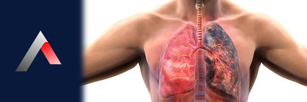 KOAH_eb72e36b.webp