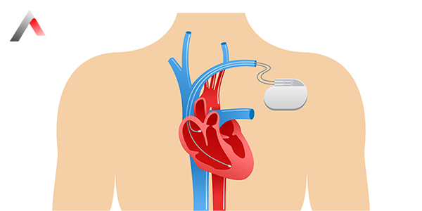 Kalp_Pili_Nas__l_Tak__l__r_539ae9c9.webp