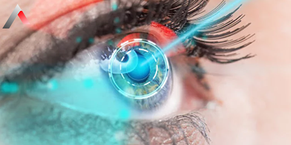 Lasik_Ameliyat___2e200325.webp