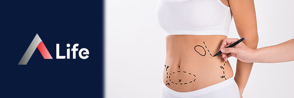 Liposuction_cfa928dc.webp
