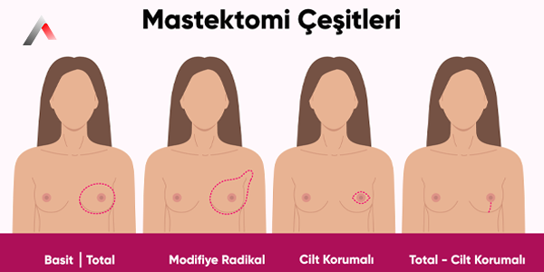 Meme_Ameliyat_____e__itleri_71d3b3cd.webp