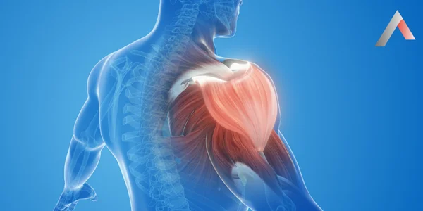 Metabolik_Cerrahi____eker_Hastal_______AmeliyaDonuk_Omuz_Nedenleri_Nelerdir_4a6b1fe6.webp