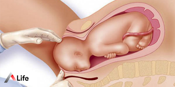 Normal_Do__um_ec7b4d29.webp