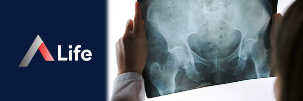 Pelvis_Grafisi____2a184af7.webp