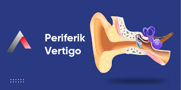 Periferik_Vertigo_57c10f73.webp