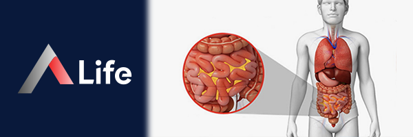 Peritonit_Nedir_70eb7f3e.webp