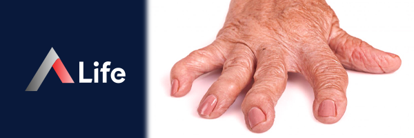 Poliartritnedirr_af29f108.webp