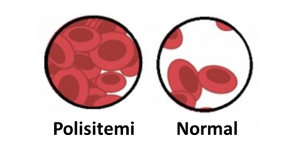 Polistemi_264bc70c.webp