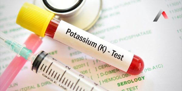 Potasyum_Testi_682a93c0.webp