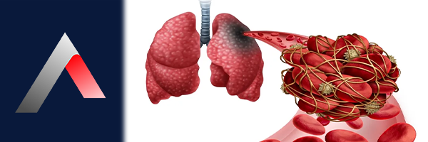 Pulmoner_Emboli_Nedir_e6adb41c.webp