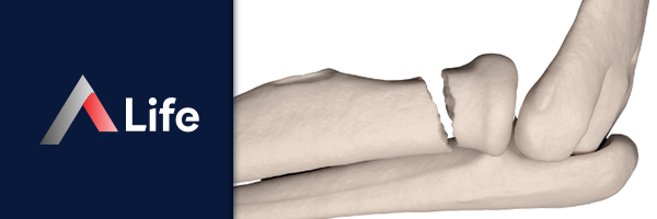 Radius_Ba_____K__r_______294e4c40.webp