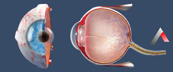 Retina_0972e04f.webp