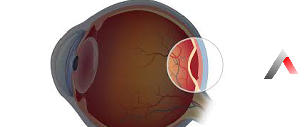 Retina_Y__rt__lmas___25ca4557.webp