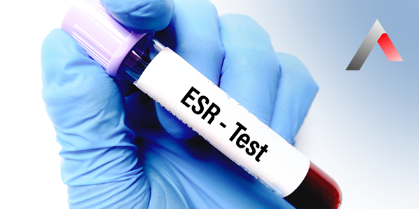 Sedimentasyon_Testi_f4c5b2e4.webp