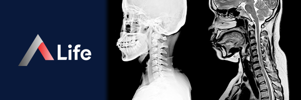 Servikal_MR_43f2367d.webp