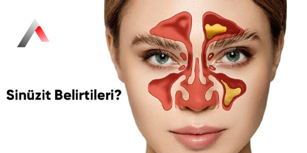Sin__zit_Belirtileri_2ae519c5.webp