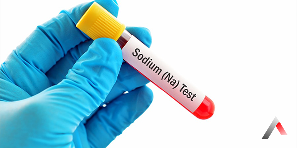 Sodyum_Testi_8911fed8.webp