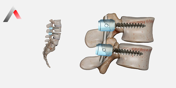 Spinal_F__zyon_Nedir_0d1ae889.webp