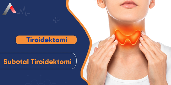 Subtotal_Tiroidektomi_5d2c41b5.webp
