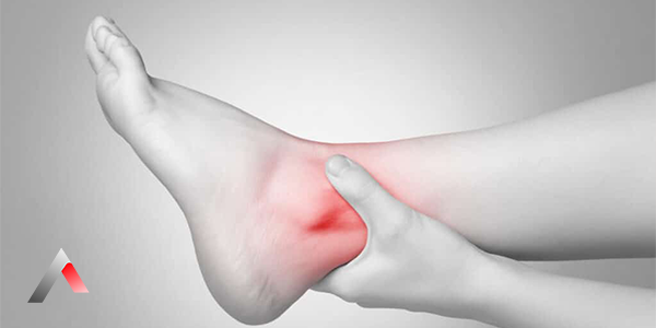 Tarsal_T__nel_A__r__s___5249246b.webp