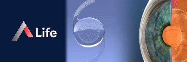 Trifokal_lensler_f637a3eb.webp