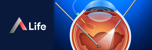 Vitrektomi_Nedir_95dc7026.webp